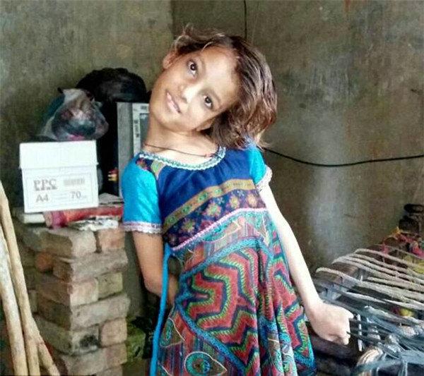 女孩头部无法竖立,被视为罪恶遭排挤