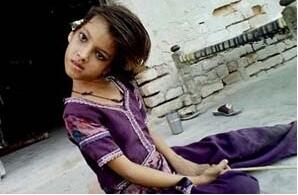 女孩头部无法竖立,被视为罪恶遭排挤