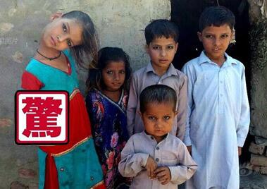 女孩头部无法竖立,被视为罪恶遭排挤