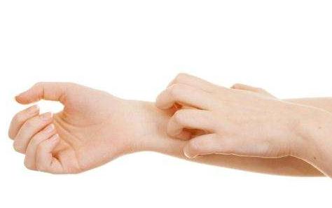 早期荨麻疹的临床表现 荨麻疹患者应该怎么护肤