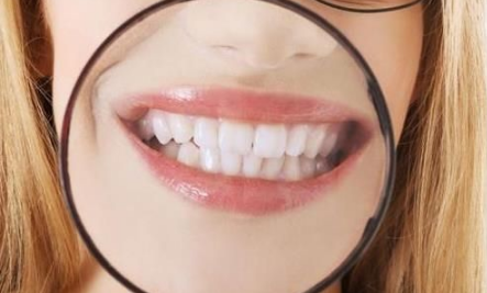 牙齿很黄怎么回事？牙齿怎样可以美白