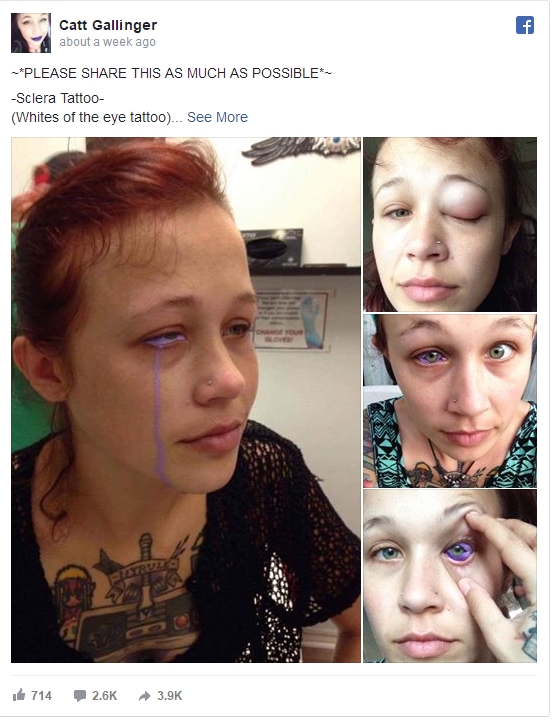 加拿大美女模特勇敢尝试眼球纹身：视力永久性被毁