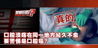 口腔溃疡在同一地方经久不愈要警惕是口腔癌？