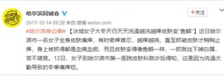 冬天多久洗一次澡最科学?据说只有10%的人能答对
