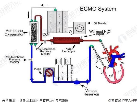 硬核！67台ECMO已发往湖北 神奇“人工肺”能从死神手中抢时间