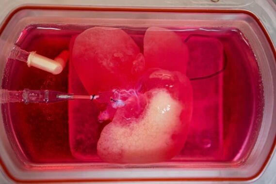 科学家用人类皮肤细胞培育的迷你肝脏成功移植到大鼠体内，且存活了4天！