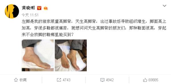 黄晓明回应垫鞋垫 真相揭晓 网友纷纷表示心疼！