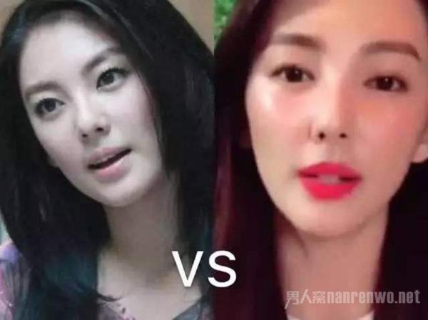 张雨绮关掉滤镜 回应整容过度传闻 网友：不买账