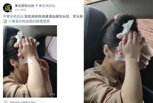 浪姐“流年不顺”接连发生意外?泥石流遇车祸 现在黄圣依头又被砸了