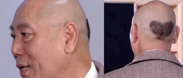 头发也可以用来宠粉：李成儒光头藏爱心 鹿晗留爱心刘海