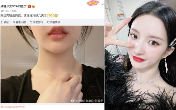 拔智齿更可爱是怎么回事？Henry乔欣肿成肉包子脸