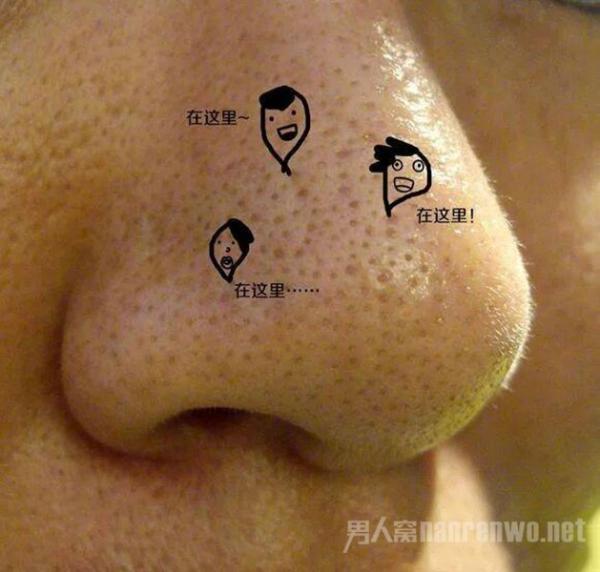 脸上出油很厉害该怎么办 注意这三点 再也没烦恼