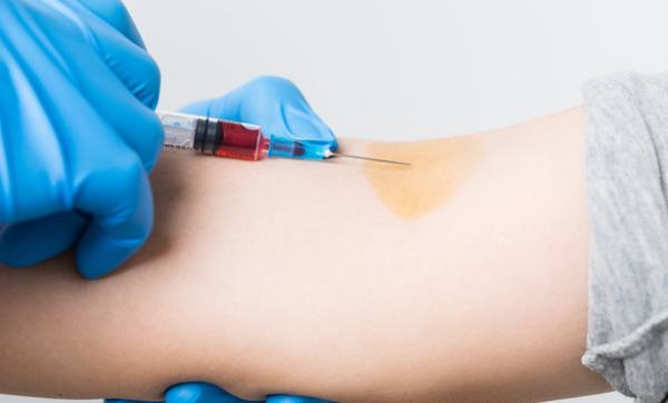 接种HPV疫苗后，能否接种新冠疫苗？专家：分开打，至少间隔两周