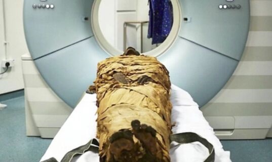 一桩2600年前谋杀案破解！著名女木乃伊是被斧头从背后砍死 凶手可能是亲人