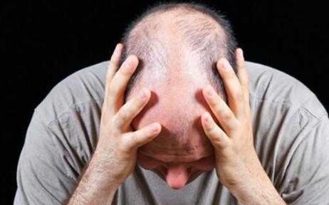 总是掉头发应该怎么办？