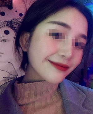 23岁再造“人工耳” 广东小耳畸形美女圆教师梦