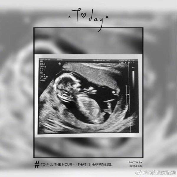 43岁蒋勤勤宣布怀孕即将生二胎 亮相获陈建斌细心呵护