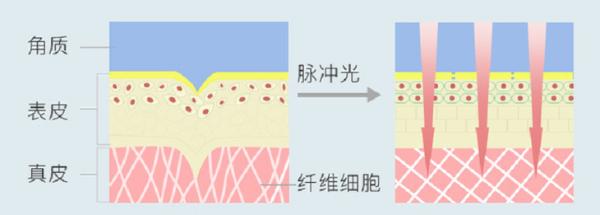 美容仪有效果吗？美肌科技帮你守护年轻肌肤