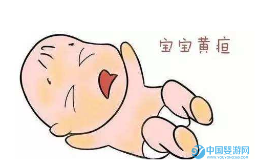 宝宝：宝宝黄疸需要停止母乳喂养吗？