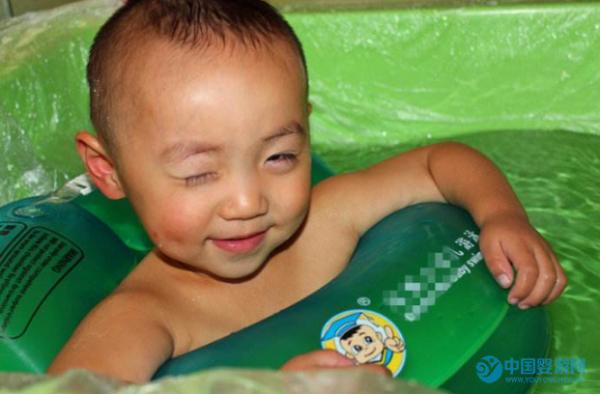 婴儿游泳可以缓解宝宝歪头问题吗？