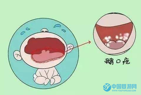 新生儿常见疾病及解决方法■新生儿常见疾病及解决方法，你值得拥有