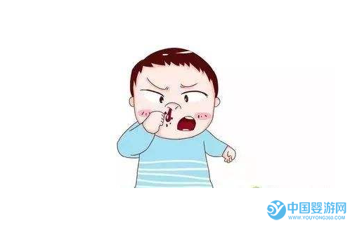 宝宝流鼻血的正确处理方式