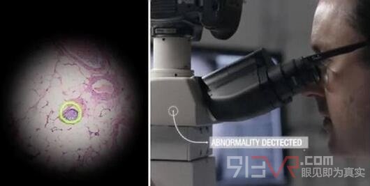 Google采用AR技术和显微镜结合用于癌症检测