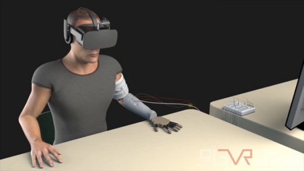 VR应用医学救治幻肢症患者
