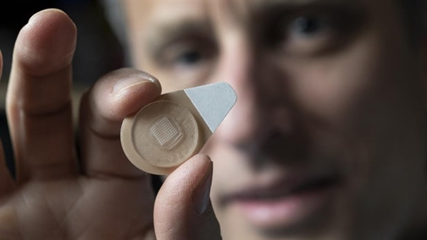 研究人员推无痛微针贴片：可提供最多6个月避孕效果