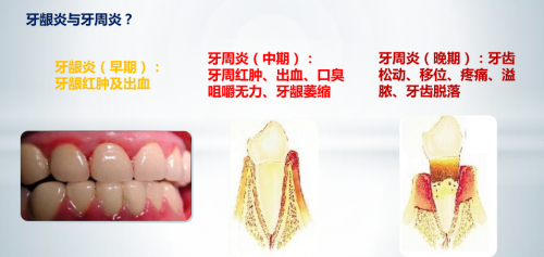 关注口腔健康，使用贝利达(BIOREPAIR)牙膏，远离牙周疾病