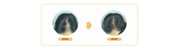 脱发自救指南：曼秀雷敦50惠养发系列让你重拾丰盈秀发！
