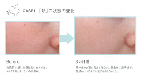 我们扒出了“白月光”秦岚小姐姐的护肤保湿秘诀-------ORBIS DEFENCERA！