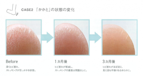 我们扒出了“白月光”秦岚小姐姐的护肤保湿秘诀-------ORBIS DEFENCERA！