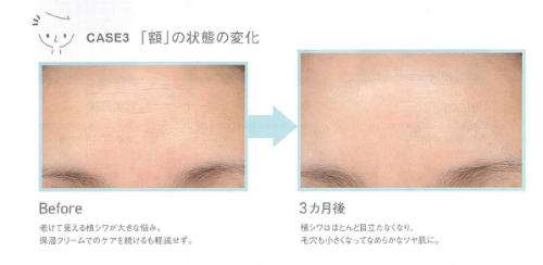 我们扒出了“白月光”秦岚小姐姐的护肤保湿秘诀-------ORBIS DEFENCERA！