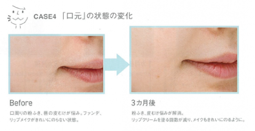 我们扒出了“白月光”秦岚小姐姐的护肤保湿秘诀-------ORBIS DEFENCERA！