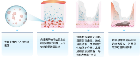 爱眼日不可错过的爱眼小知识