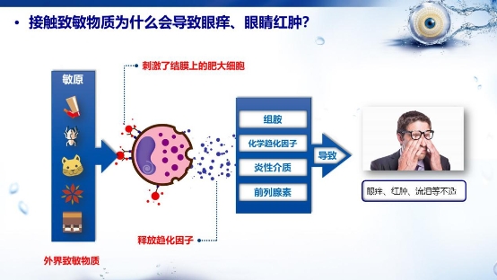 爱眼日不可错过的爱眼小知识