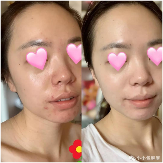 RECIPE美白淡斑霜，名主持人李湘品质推荐！