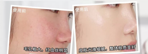 熬夜看完令人心动的offer，韩束红胶囊水给你令人心动的美肌