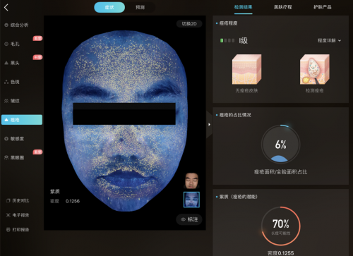 美图宜肤评测：市面上更精准更科学的测肤仪