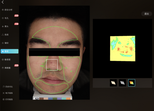 美图宜肤评测：市面上更精准更科学的测肤仪