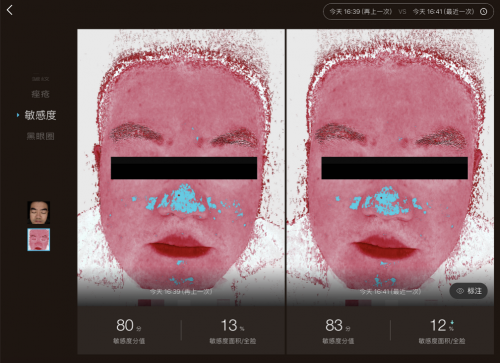 美图宜肤评测：市面上更精准更科学的测肤仪