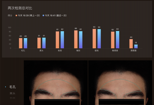 美图宜肤评测：市面上更精准更科学的测肤仪