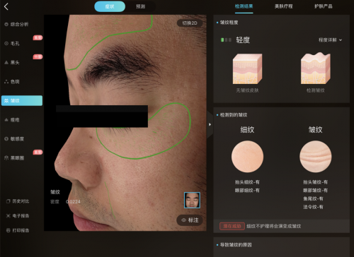 美图宜肤评测：市面上更精准更科学的测肤仪