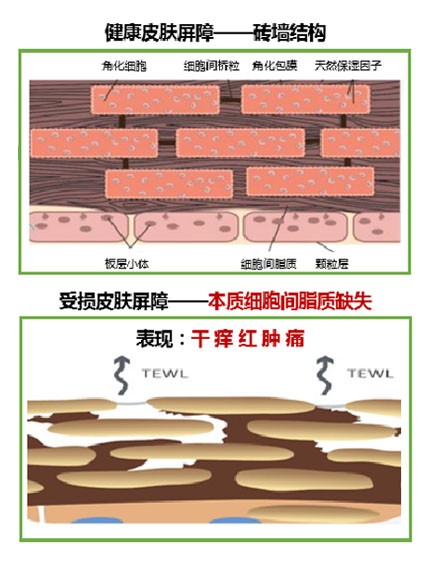 有90%的肌肤亚健康问题，一直被大家忽略了