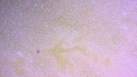 科普：发芽的土豆还能食用吗？