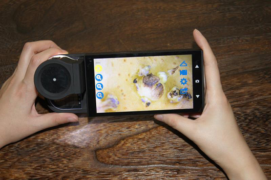 科普：发芽的土豆还能食用吗？