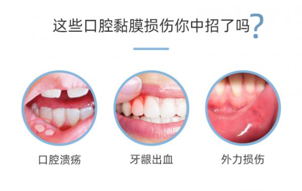合和泰蜂胶夜间修护(AVE)牙膏 带你告别口腔溃疡这“会呼吸的痛”