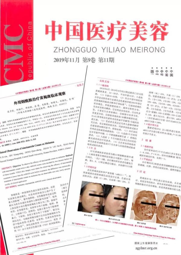 通过临床观察 优斐斯烟酰胺精华液治疗黄褐斑效果明显