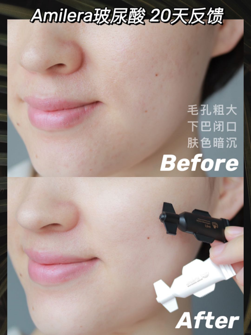 Amilera获得的德国护肤品GMP、Dermatest、MEDCERT认证到底是什么